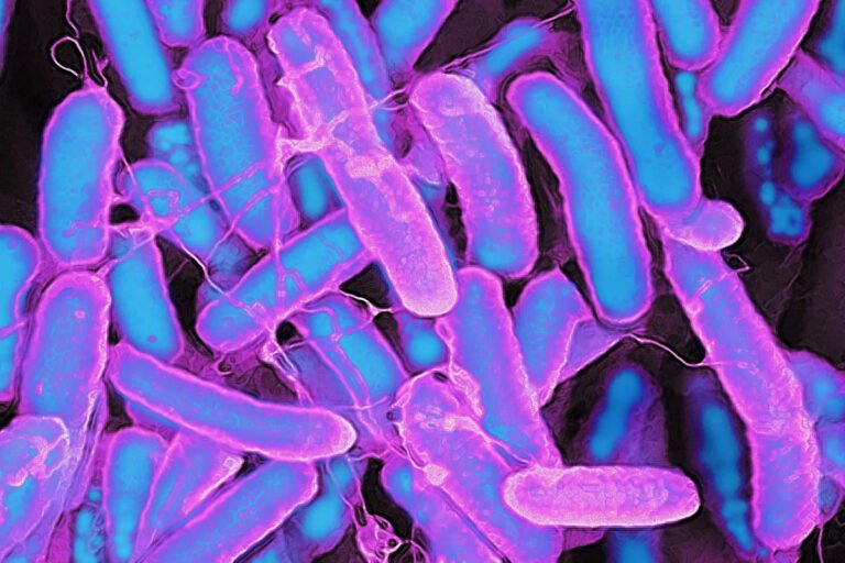 How Diet, Gut Bacteria, and Early Childhood Could Be Shaping Colon Cancer Risk