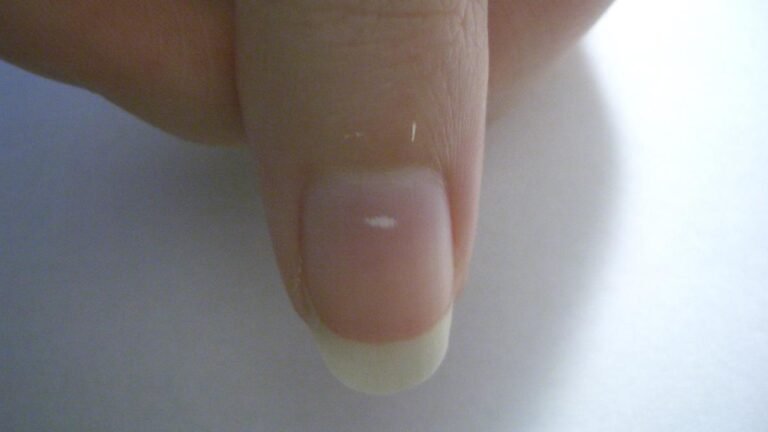 What changes in your nails may reveal about nutrition, trauma and chronic disease